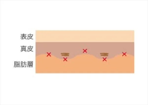 アポクリン腺は真皮より下の脂肪層に多く分布