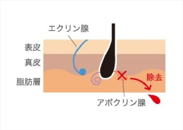 エクリン腺