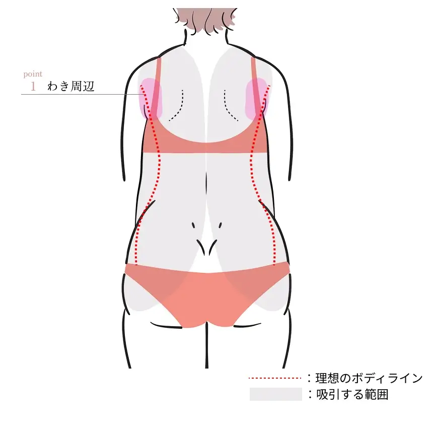 POINT1. わき周辺