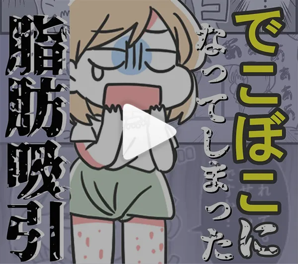 でこぼこになってしまった脂肪吸引