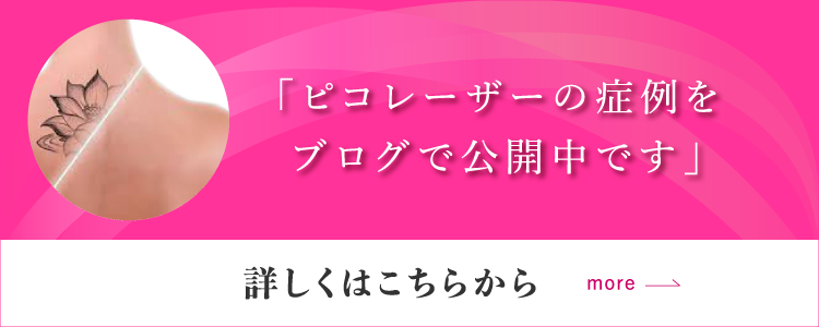 ピコレーザーの症例をブログで公開中です